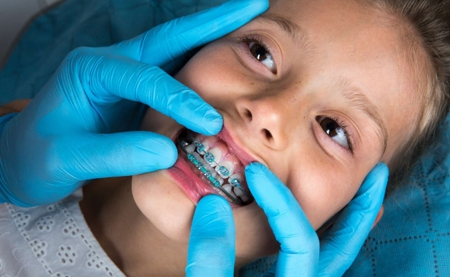 Early orthodontic evaluation------32