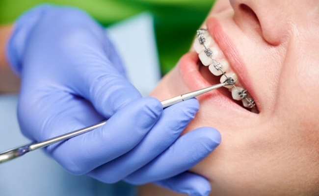 Orthodontic Services
