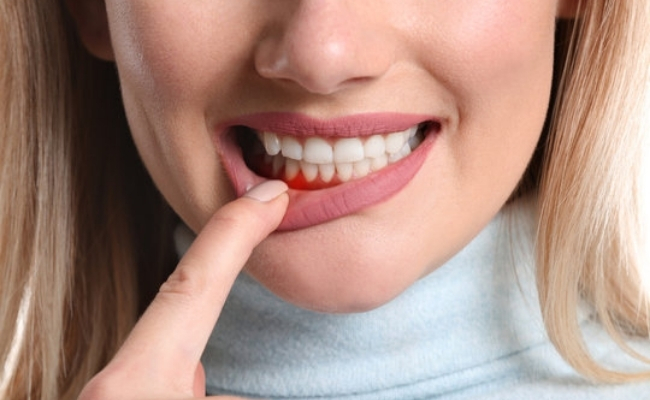 Periodontal Services
