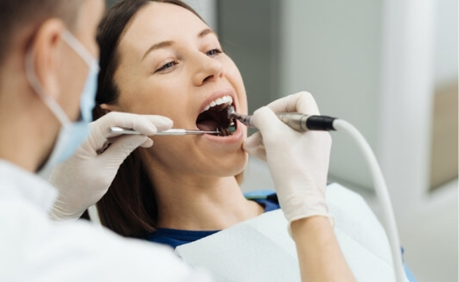 Professional teeth cleaning (scaling and polishing)-------32