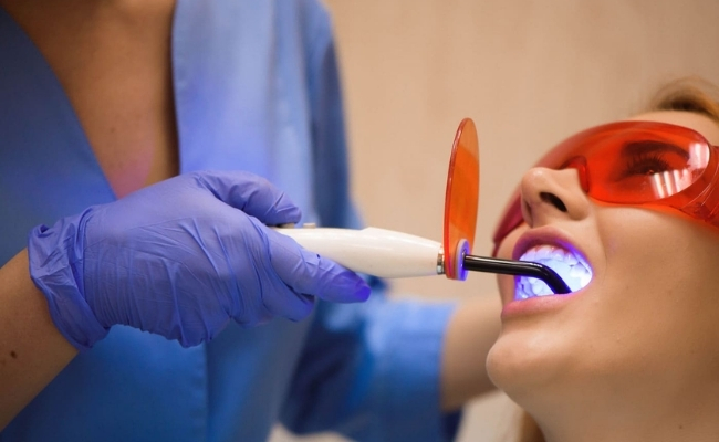 Teeth whitening-